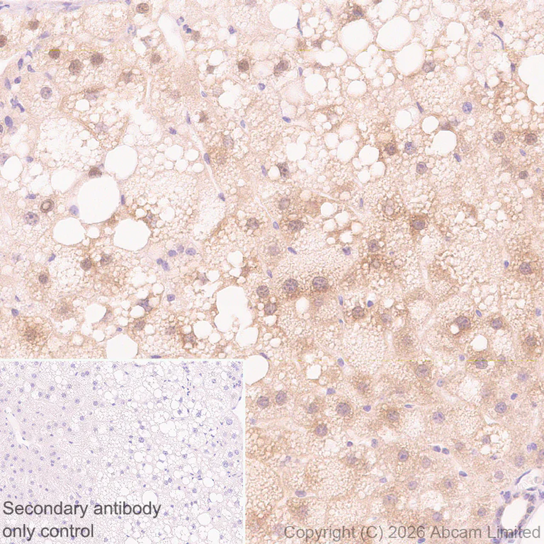 Immunohistochemistry (Formalin/PFA-fixed paraffin-embedded sections) - Anti-SREBP1 antibody [EPR30539-645] (AB326106)