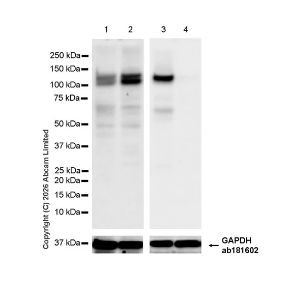 Western blot - Anti-SREBP1 antibody [EPR30539-645] (AB326106)