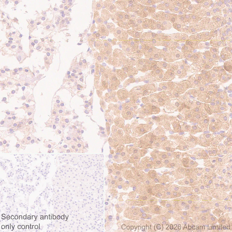Immunohistochemistry (Formalin/PFA-fixed paraffin-embedded sections) - Anti-SREBP1 antibody [EPR30539-645] - BSA and Azide free (AB326109)
