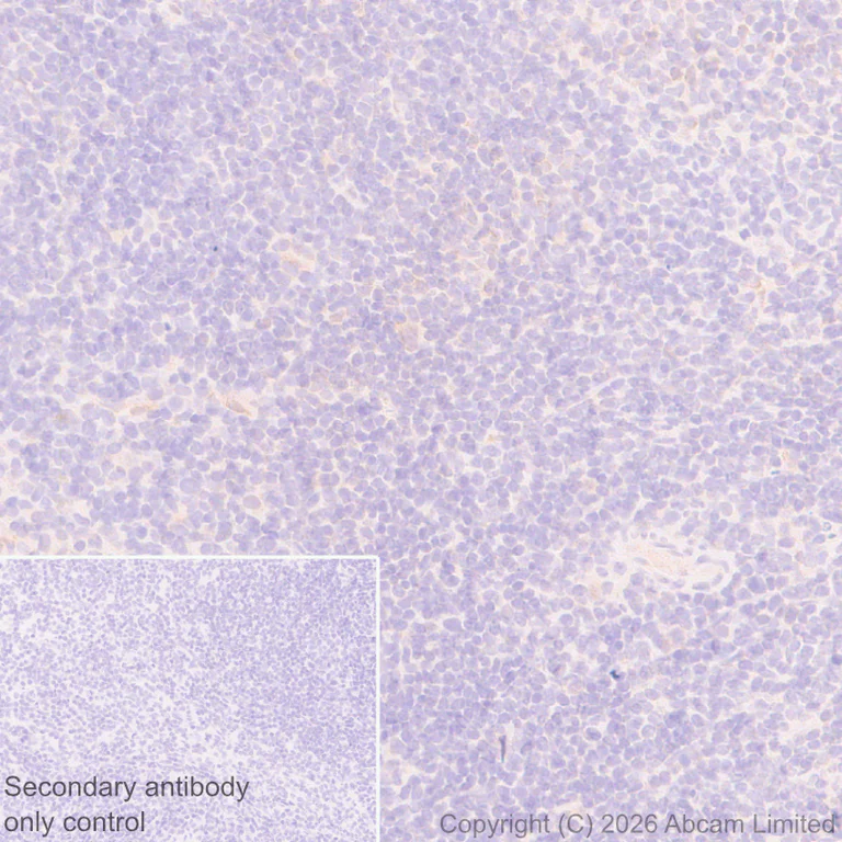 Immunohistochemistry (Formalin/PFA-fixed paraffin-embedded sections) - Anti-SREBP1 antibody [EPR30539-645] - BSA and Azide free (AB326109)