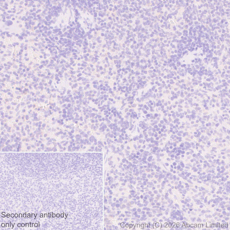 Immunohistochemistry (Formalin/PFA-fixed paraffin-embedded sections) - Anti-SREBP1 antibody [EPR30539-645] - BSA and Azide free (AB326109)