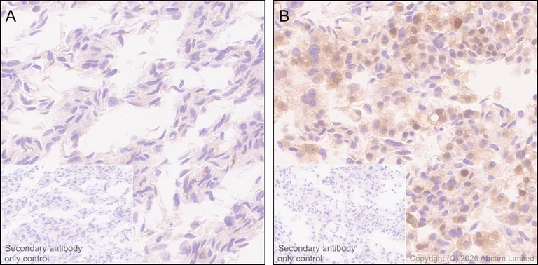 Immunohistochemistry (Formalin/PFA-fixed paraffin-embedded sections) - Anti-SREBP1 antibody [EPR30539-645] - BSA and Azide free (AB326109)