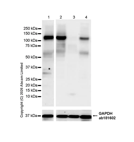 Western blot - Anti-SREBP1 antibody [EPR30539-645] - BSA and Azide free (AB326109)