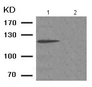 Western blot - Anti-SREBP1 (phospho S439) antibody (AB193318)