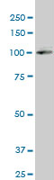 Western blot - Anti-SREBP2 antibody (AB194667), expandable thumbnail