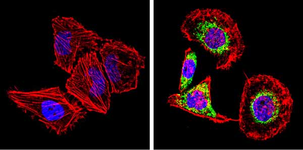 Immunocytochemistry/ Immunofluorescence - Anti-SREBP2 antibody (AB28482)
