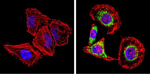 Immunocytochemistry/ Immunofluorescence - Anti-SREBP2 antibody (AB28482)