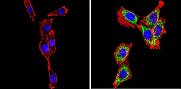 Immunocytochemistry/ Immunofluorescence - Anti-SREBP2 antibody (AB28482)
