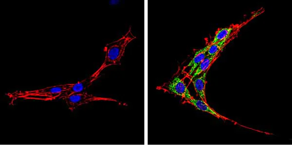 Immunocytochemistry/ Immunofluorescence - Anti-SREBP2 antibody (AB28482)
