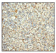 Immunohistochemistry (Formalin/PFA-fixed paraffin-embedded sections) - Anti-SREC-I antibody [EPR3848] (AB92308)