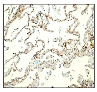 Immunohistochemistry (Formalin/PFA-fixed paraffin-embedded sections) - Anti-SREC-I antibody [EPR3848] - BSA and Azide free (AB247534)
