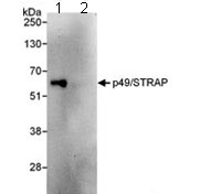Immunoprecipitation - Anti-SRFBP1 antibody (AB109598), expandable thumbnail