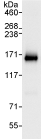 Immunoprecipitation - Anti-SRGAP1 antibody (AB75281), expandable thumbnail