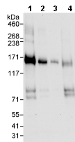 Western blot - Anti-SRGAP1 antibody (AB76926), expandable thumbnail