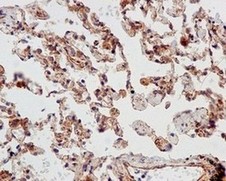 Immunohistochemistry (Formalin/PFA-fixed paraffin-embedded sections) - Anti-SRGAP1 antibody [EPR8760(2)] (AB171938), expandable thumbnail