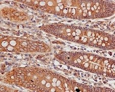 Immunohistochemistry (Formalin/PFA-fixed paraffin-embedded sections) - Anti-SRGAP1 antibody [EPR8760(2)] - BSA and Azide free (AB249658), expandable thumbnail