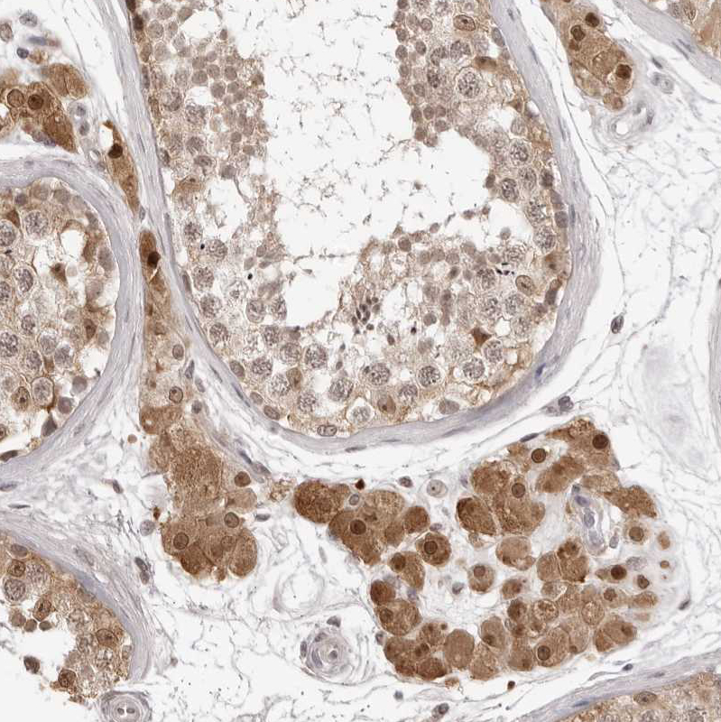 Immunohistochemistry (Formalin/PFA-fixed paraffin-embedded sections) - Anti-srGAP2 antibody (AB121977)