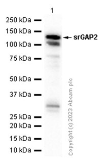 Western blot - Anti-srGAP2 antibody [EP2506(2)] (AB124958), expandable thumbnail