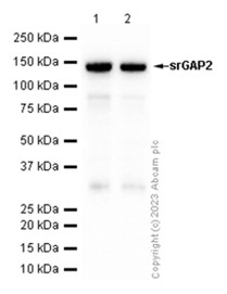 Western blot - Anti-srGAP2 antibody [EP2506(2)] (AB124958), expandable thumbnail