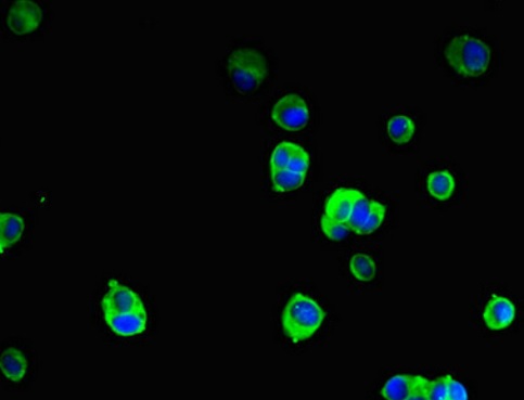 Immunocytochemistry/ Immunofluorescence - Anti-SRGAP2B antibody (AB222902), expandable thumbnail
