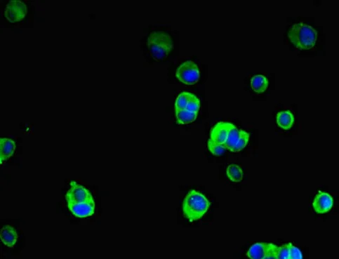 Immunocytochemistry/ Immunofluorescence - Anti-SRGAP2B antibody (AB222902)