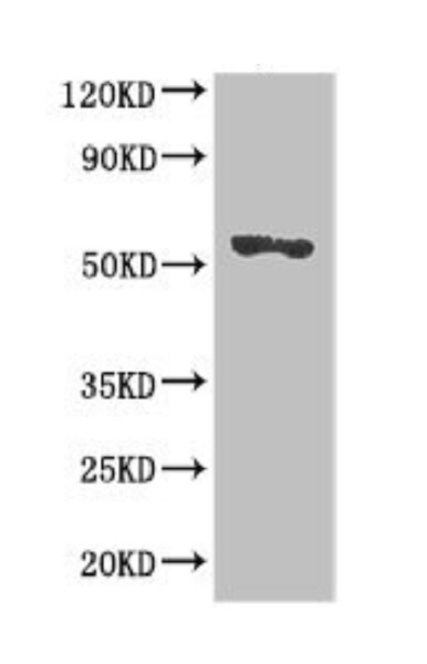 Western blot - Anti-SRGAP2B antibody (AB222902), expandable thumbnail