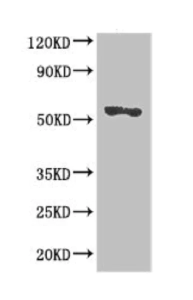 Western blot - Anti-SRGAP2B antibody (AB222902)