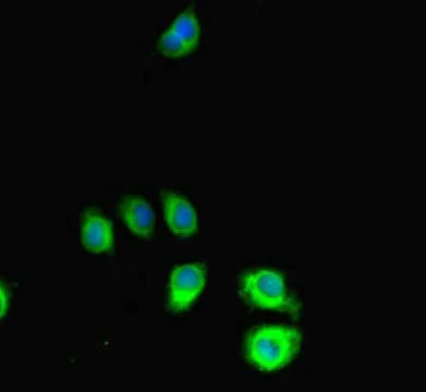 Immunocytochemistry/ Immunofluorescence - Anti-SRGAP2C antibody (AB222799)