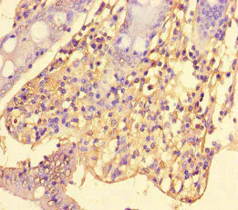 Immunohistochemistry (Formalin/PFA-fixed paraffin-embedded sections) - Anti-SRGAP2C antibody (AB222799)