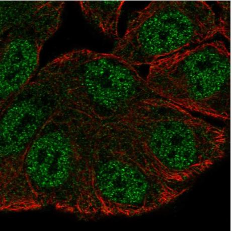Immunocytochemistry/ Immunofluorescence - Anti-srGAP3 antibody (AB204408)