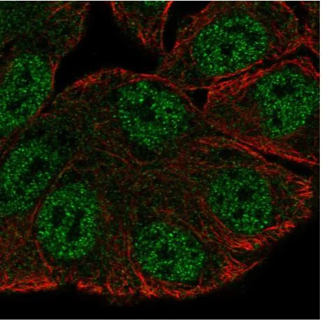 Immunocytochemistry/ Immunofluorescence - Anti-srGAP3 antibody (AB204408)