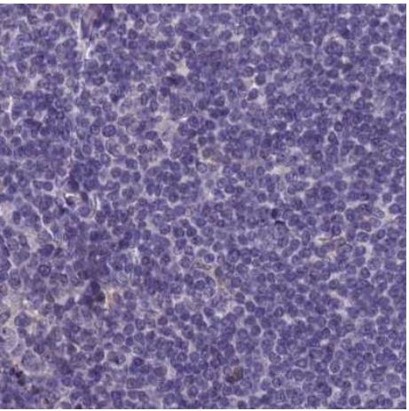 Immunohistochemistry (Formalin/PFA-fixed paraffin-embedded sections) - Anti-srGAP3 antibody (AB204408)