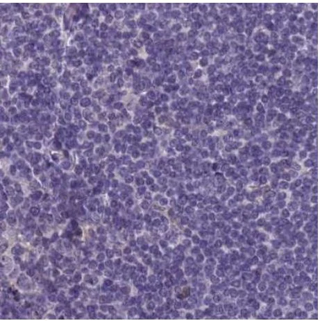 Immunohistochemistry (Formalin/PFA-fixed paraffin-embedded sections) - Anti-srGAP3 antibody (AB204408)