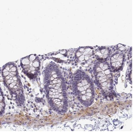 Immunohistochemistry (Formalin/PFA-fixed paraffin-embedded sections) - Anti-srGAP3 antibody (AB204408)