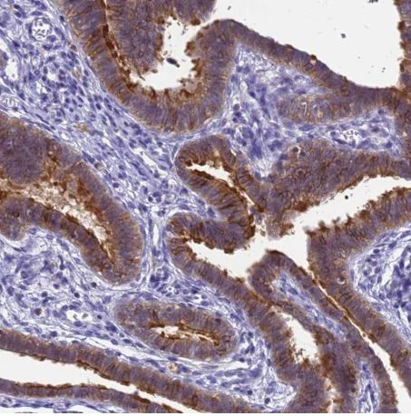 Immunohistochemistry (Formalin/PFA-fixed paraffin-embedded sections) - Anti-srGAP3 antibody (AB204408)