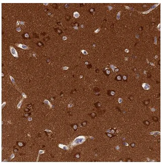Immunohistochemistry (Formalin/PFA-fixed paraffin-embedded sections) - Anti-srGAP3 antibody (AB204408)