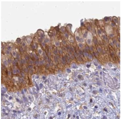 Immunohistochemistry (Formalin/PFA-fixed paraffin-embedded sections) - Anti-srGAP3 antibody (AB204408)