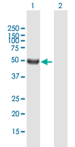 Western blot - Anti-SRMS antibody (AB167598)