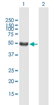 Western blot - Anti-SRMS antibody (AB167598)