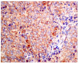 Immunohistochemistry (Formalin/PFA-fixed paraffin-embedded sections) - Anti-SRP54 antibody [EPR10851(B)] (AB154796), expandable thumbnail