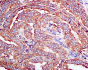 Immunohistochemistry (Formalin/PFA-fixed paraffin-embedded sections) - Anti-SRP54 antibody [EPR10851(B)] (AB154796), expandable thumbnail