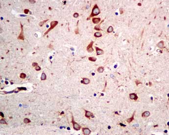 Immunohistochemistry (Formalin/PFA-fixed paraffin-embedded sections) - Anti-SRP54 antibody [EPR10851(B)] (AB154796), expandable thumbnail