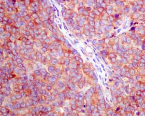 Immunohistochemistry (Formalin/PFA-fixed paraffin-embedded sections) - Anti-SRP54 antibody [EPR10851(B)] - BSA and Azide free (AB249104)