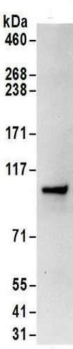 Immunoprecipitation - Anti-SRP68 antibody (AB157120)