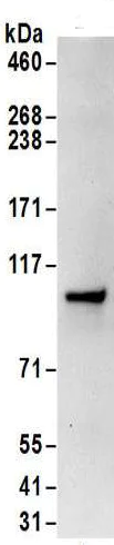 Immunoprecipitation - Anti-SRP68 antibody (AB157120)