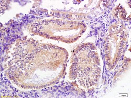 Immunohistochemistry (Formalin/PFA-fixed paraffin-embedded sections) - Anti-SRP68 antibody (AB217372), expandable thumbnail