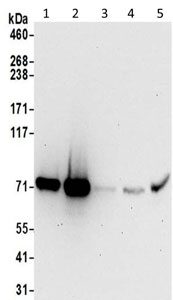 Western blot - Anti-SRP72 antibody - C-terminal (AB195308), expandable thumbnail