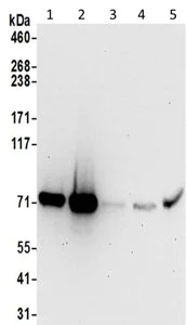 Western blot - Anti-SRP72 antibody - C-terminal (AB195308)