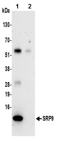 Immunoprecipitation - Anti-SRP9 antibody (AB241989), expandable thumbnail