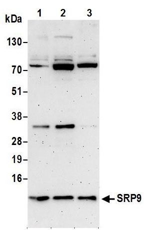Western blot - Anti-SRP9 antibody (AB241989), expandable thumbnail
